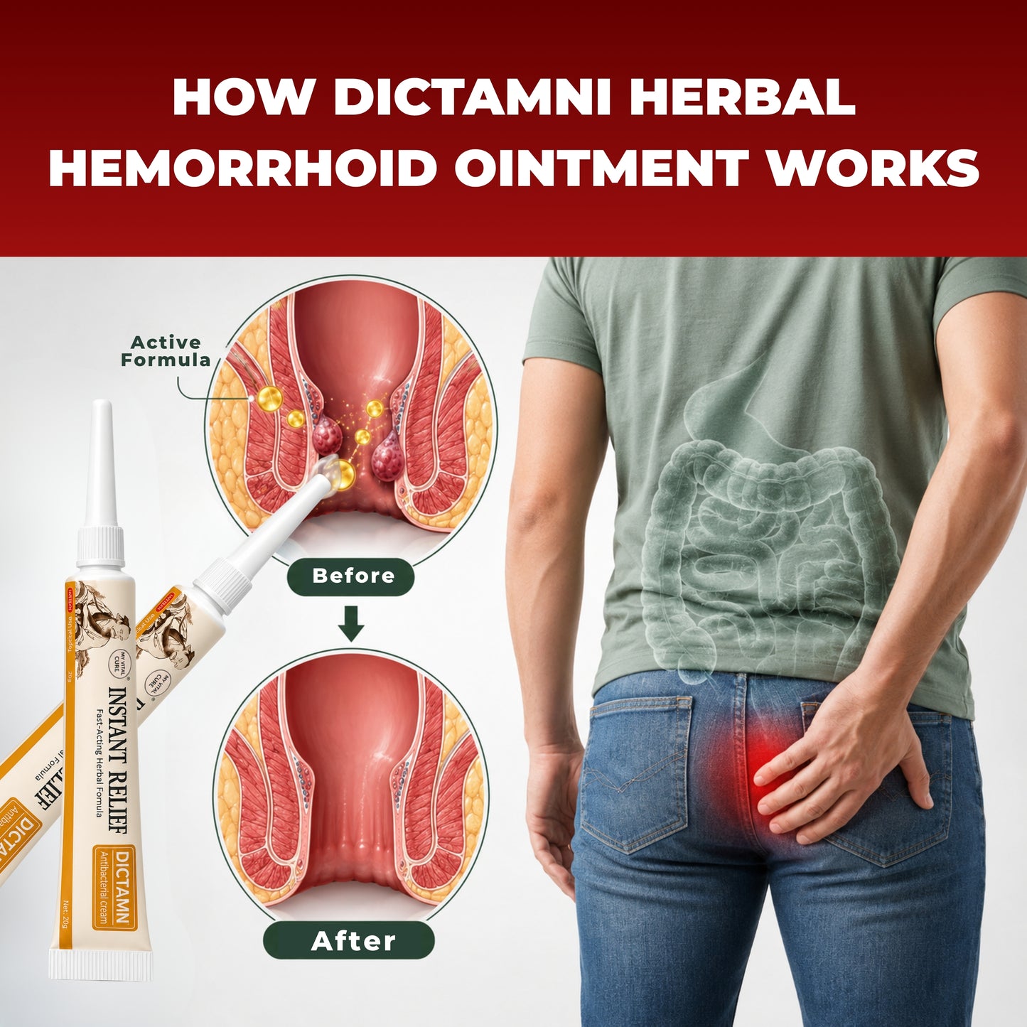 Dictamni Herbal Hemorrhoid Ointment — Buy 2, Get 1 Free