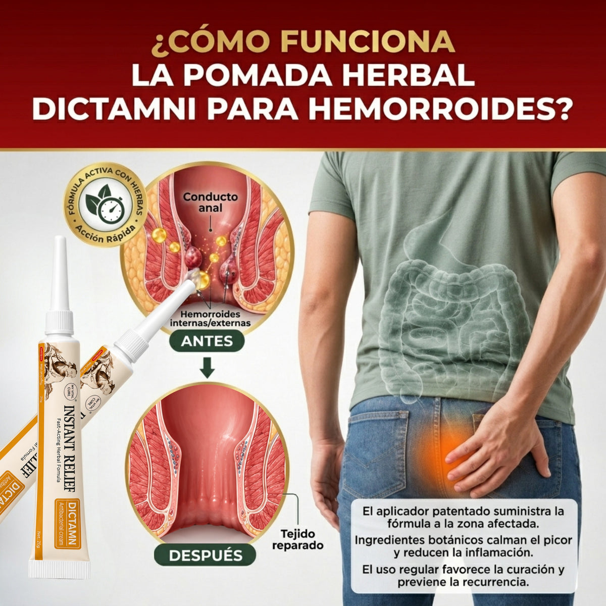 Pomada para las hemorroides a base de hierbas Dictamni — 3 unidades
